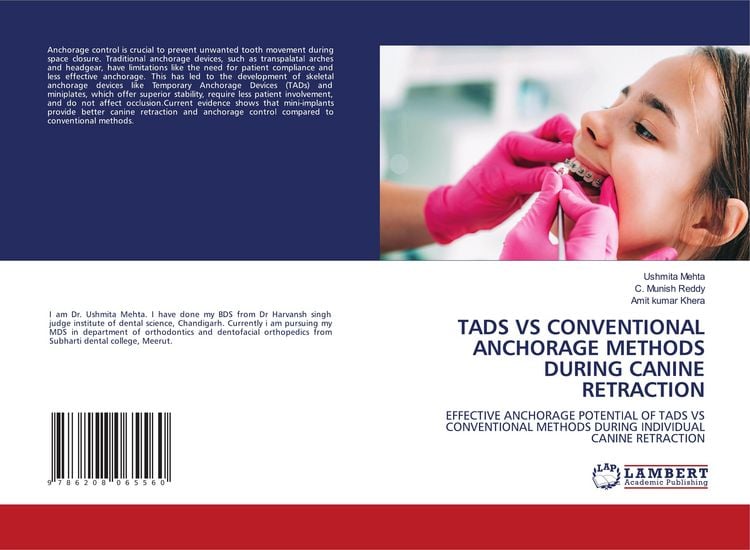 Produktbild: Tads Vs Conventional Anchorage Methods During Canine Retraction