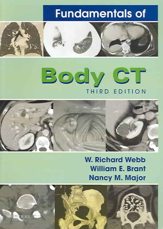 Produktbild: Fundamentals of Body CT