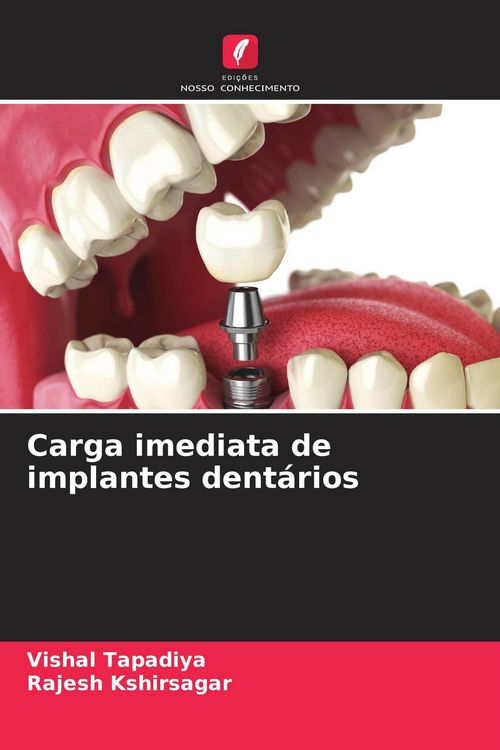 Produktbild: Carga imediata de implantes dent&aacute;rios