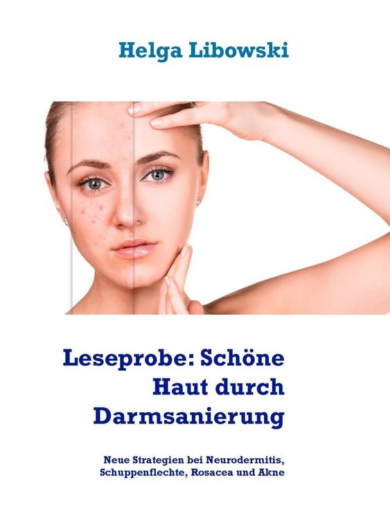 Produktbild: Leseprobe: Sch&ouml;ne Haut durch Darmsanierung