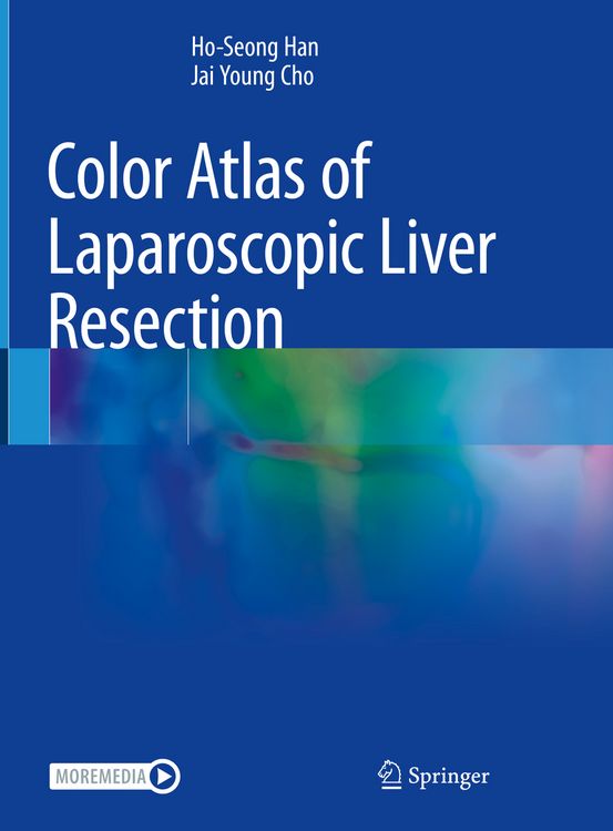 Produktbild: Color Atlas of Laparoscopic Liver Resection