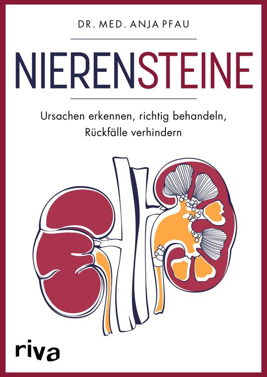 Produktbild: Nierensteine - Ursachen erkennen, richtig behandeln, Rückfälle verhindern