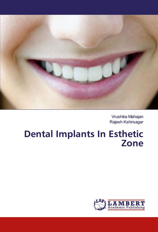 Produktbild: Dental Implants In Esthetic Zone