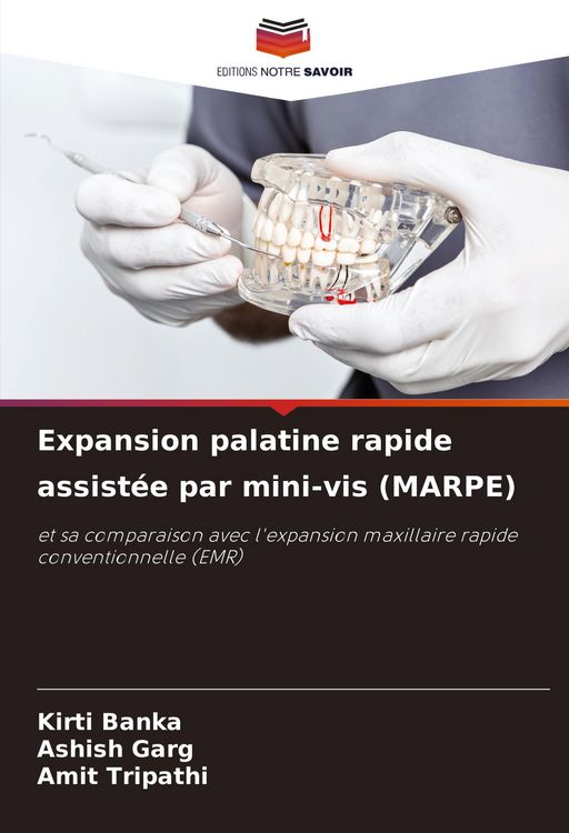 Produktbild: Expansion palatine rapide assist&eacute;e par mini-vis (MARPE)