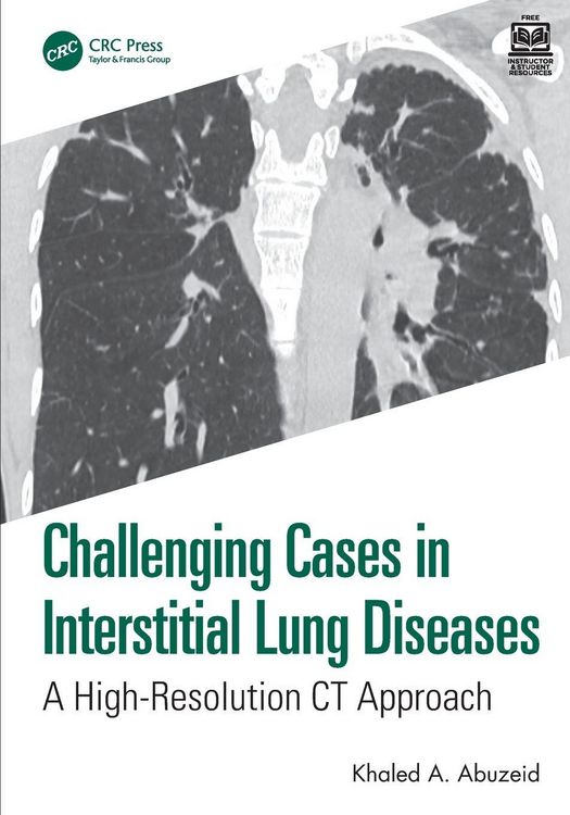 Produktbild: Challenging Cases in Interstitial Lung Diseases