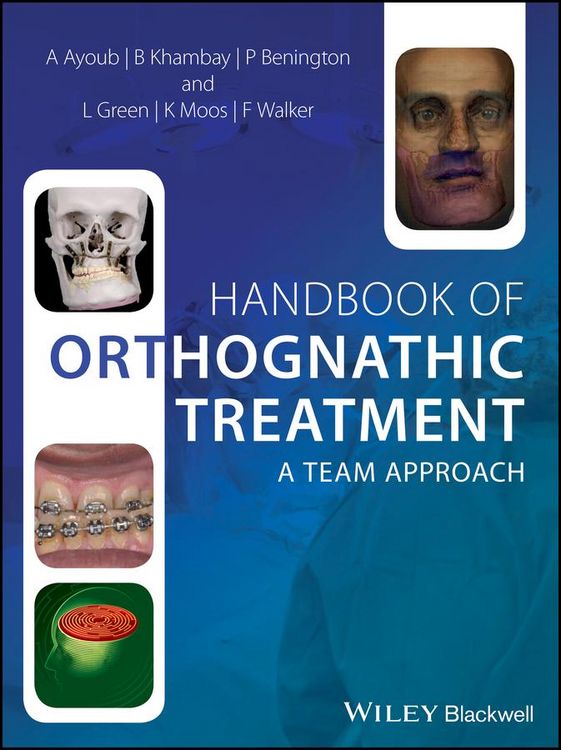 Produktbild: Handbook of Orthognathic Treatment