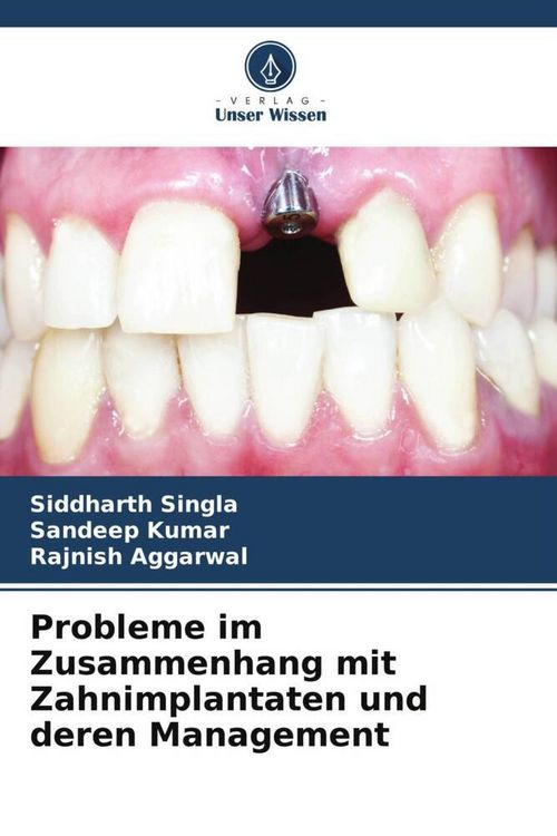 Produktbild: Probleme im Zusammenhang mit Zahnimplantaten und deren Management