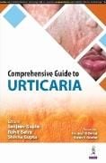 Produktbild: Comprehensive Guide to Urticaria