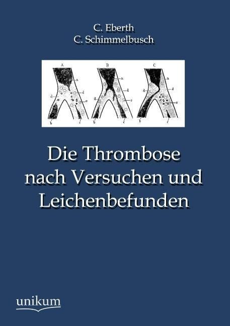 Produktbild: Eberth, C: Thrombose nach Versuchen und Leichenbefunden
