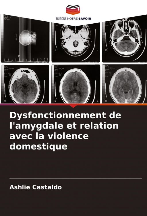 Produktbild: Dysfonctionnement de l'amygdale et relation avec la violence domestique
