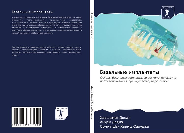 Produktbild: Bazal'nye implantaty
