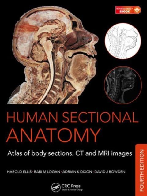 Produktbild: Human Sectional Anatomy
