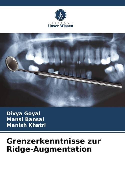 Produktbild: Grenzerkenntnisse zur Ridge-Augmentation