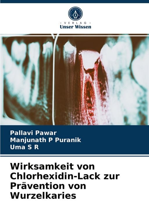 Produktbild: Wirksamkeit von Chlorhexidin-Lack zur Pr&auml;vention von Wurzelkaries