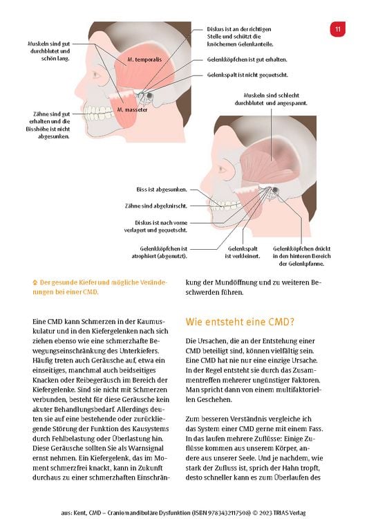 Produktbild: CMD - Craniomandibul&auml;re Dysfunktion