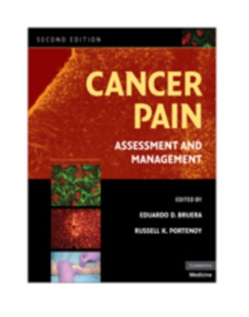 Produktbild: Cancer Pain