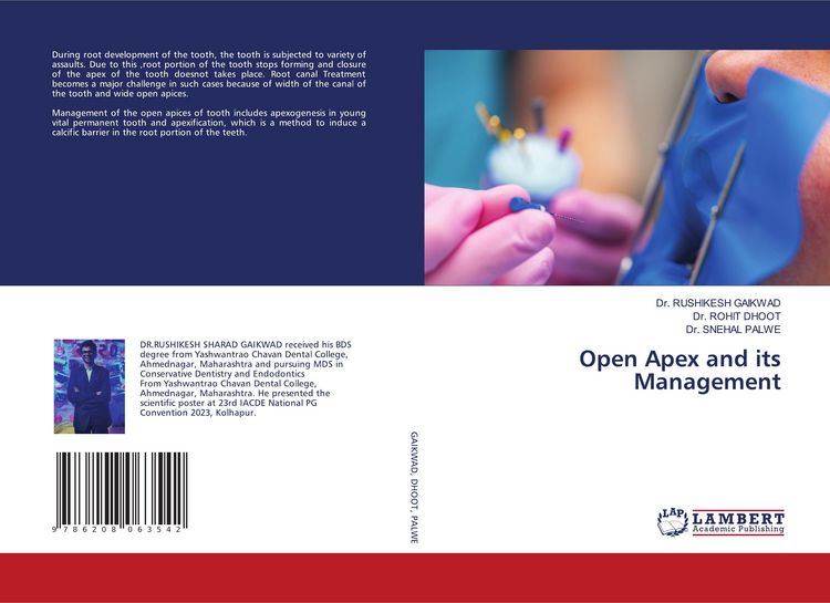 Produktbild: Open Apex and its Management