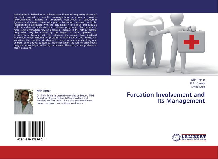 Produktbild: Furcation Involvement and Its Management