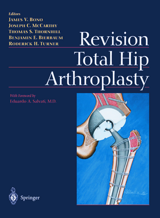 Produktbild: Revision Total Hip Arthroplasty