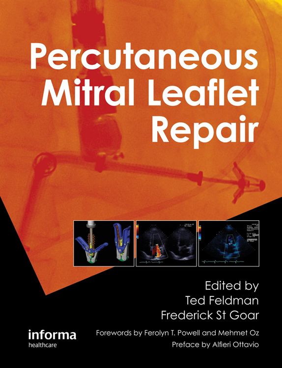 Produktbild: Percutaneous Mitral Leaflet Repair