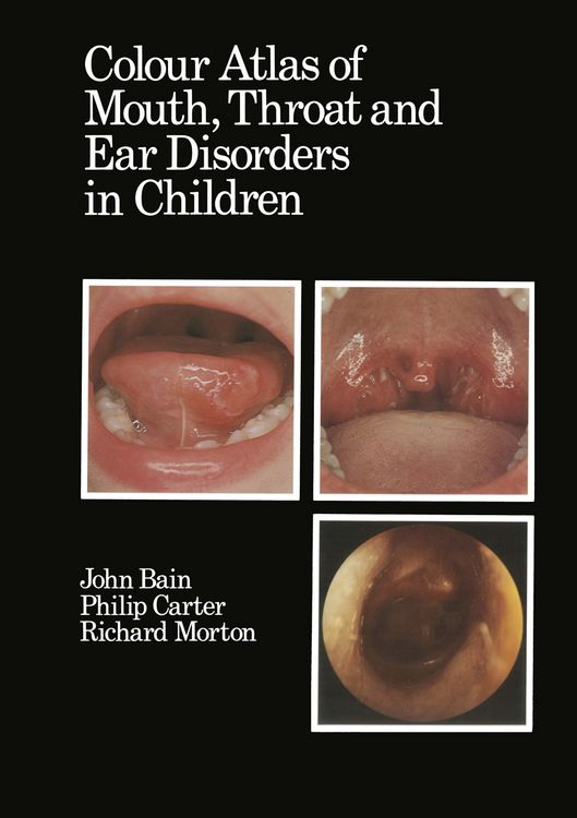 Produktbild: Colour Atlas of Mouth, Throat and Ear Disorders in Children