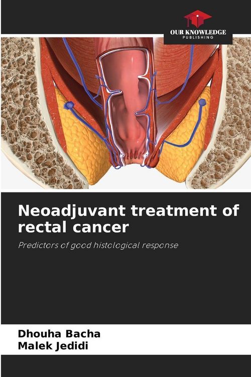 Produktbild: Neoadjuvant treatment of rectal cancer