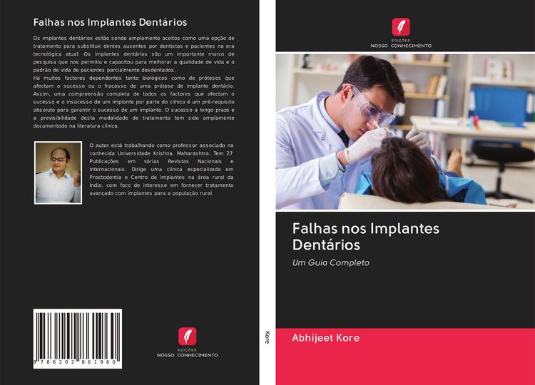 Produktbild: Falhas nos Implantes Dent&aacute;rios