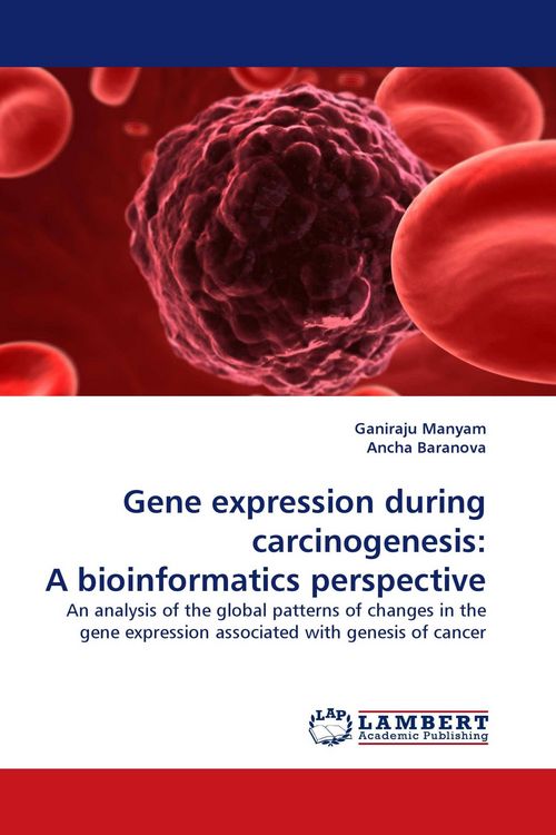 Produktbild: Gene expression during carcinogenesis: A bioinformatics perspective