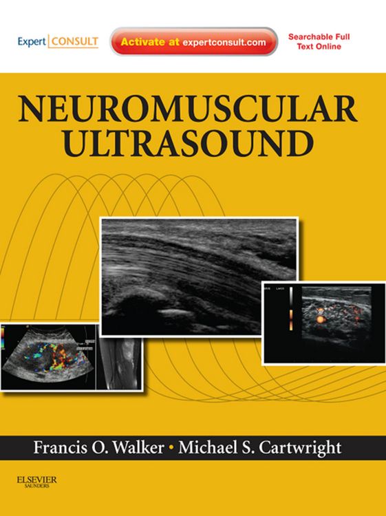 Produktbild: Neuromuscular Ultrasound E-Book