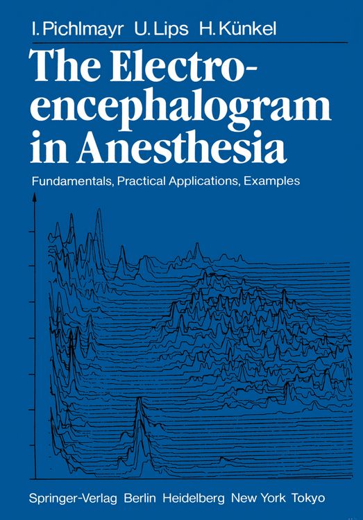Produktbild: The Electroencephalogram in Anesthesia
