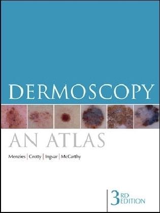 Produktbild: Menzies, S: Dermoscopy: An Atlas