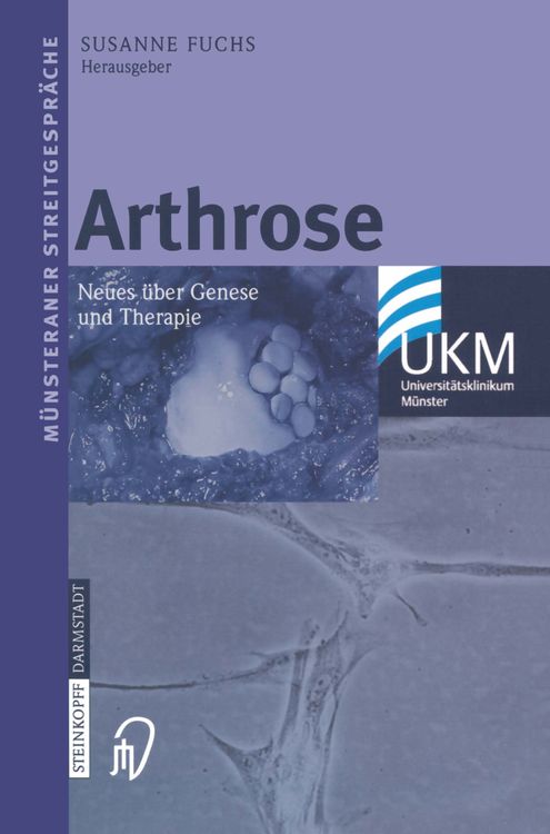 Produktbild: Arthrose