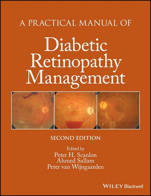 Produktbild: A Practical Manual of Diabetic Retinopathy Management