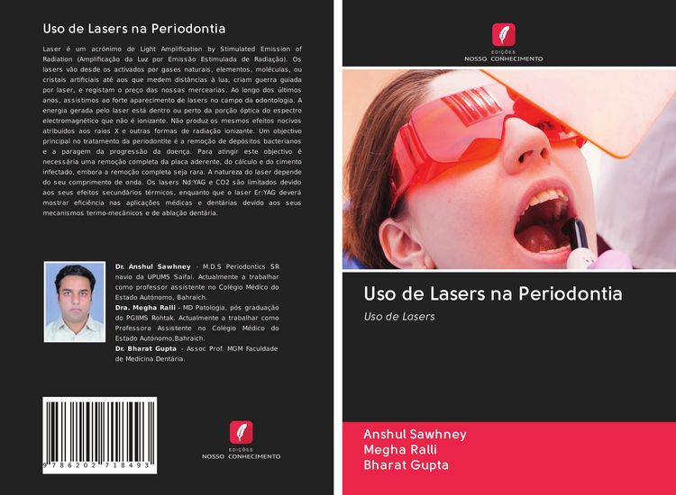Produktbild: Uso de Lasers na Periodontia