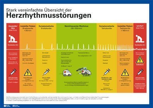 Produktbild: Herzrhythmusst&ouml;rungen