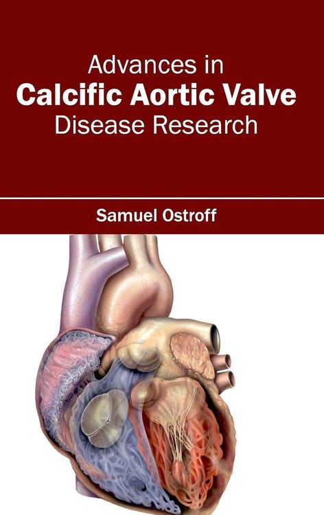 Produktbild: Advances in Calcific Aortic Valve Disease Research