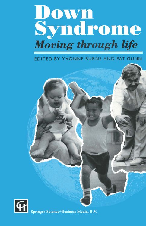 Produktbild: Down Syndrome