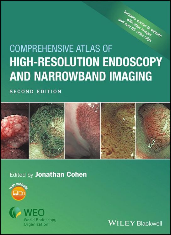 Produktbild: Comprehensive Atlas of High-Resolution Endoscopy and Narrowband Imaging