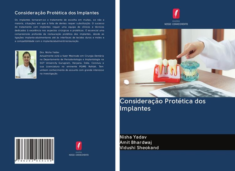 Produktbild: Considera&ccedil;&atilde;o Prot&eacute;tica dos Implantes
