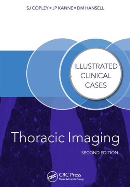 Produktbild: Thoracic Imaging
