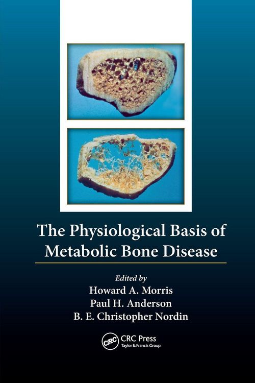 Produktbild: The Physiological Basis of Metabolic Bone Disease