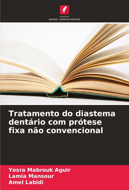 Produktbild: Tratamento do diastema dent&aacute;rio com pr&oacute;tese fixa n&atilde;o convencional