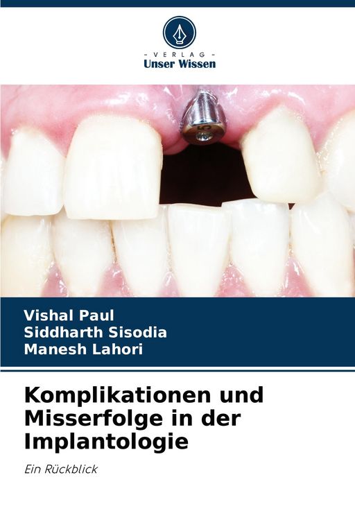 Produktbild: Komplikationen und Misserfolge in der Implantologie