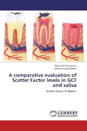 Produktbild: Chickanna, R: Comparative evaluation of Scatter Factor level