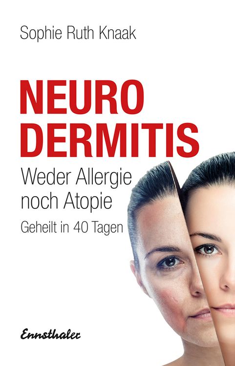Produktbild: Neurodermitis