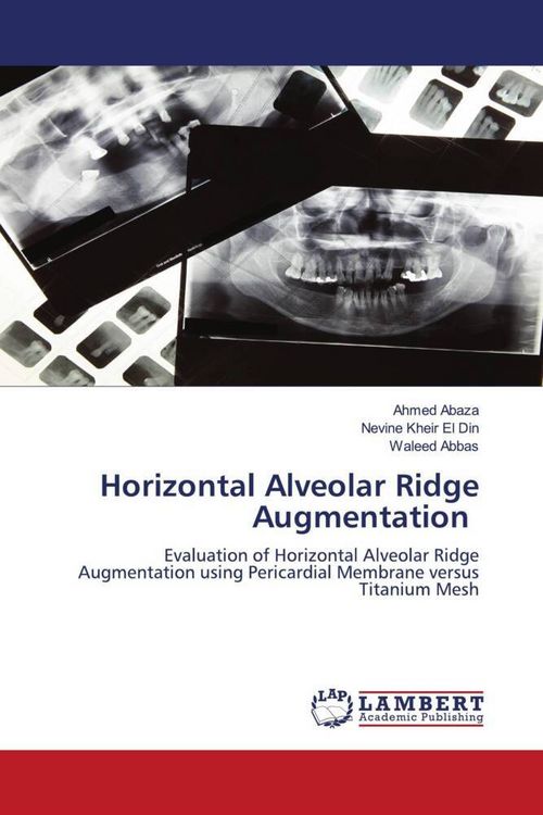 Produktbild: Horizontal Alveolar Ridge Augmentation