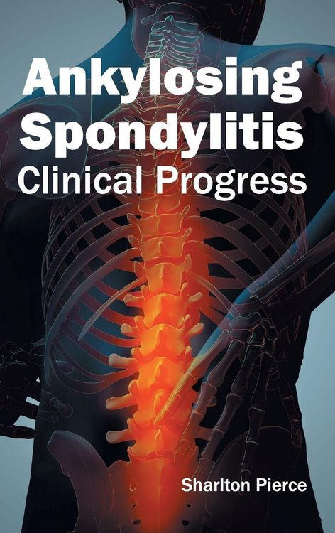 Produktbild: Ankylosing Spondylitis