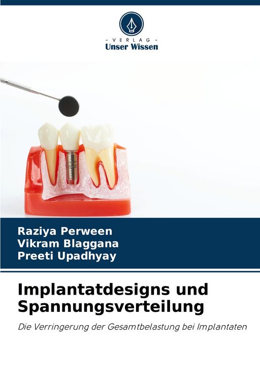 Produktbild: Implantatdesigns und Spannungsverteilung