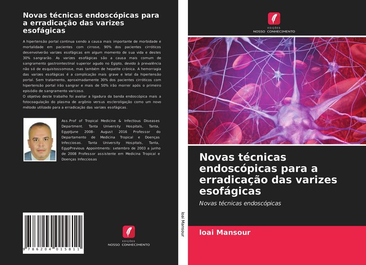 Produktbild: Novas t&eacute;cnicas endosc&oacute;picas para a erradica&ccedil;&atilde;o das varizes esof&aacute;gicas