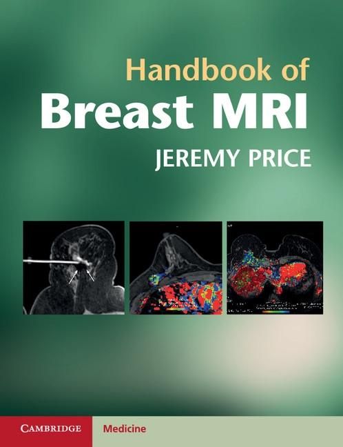 Produktbild: Handbook of Breast MRI